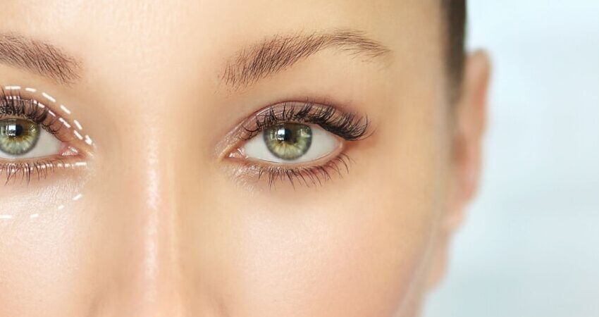 Eyelid Surgery in Istanbul, Turkey